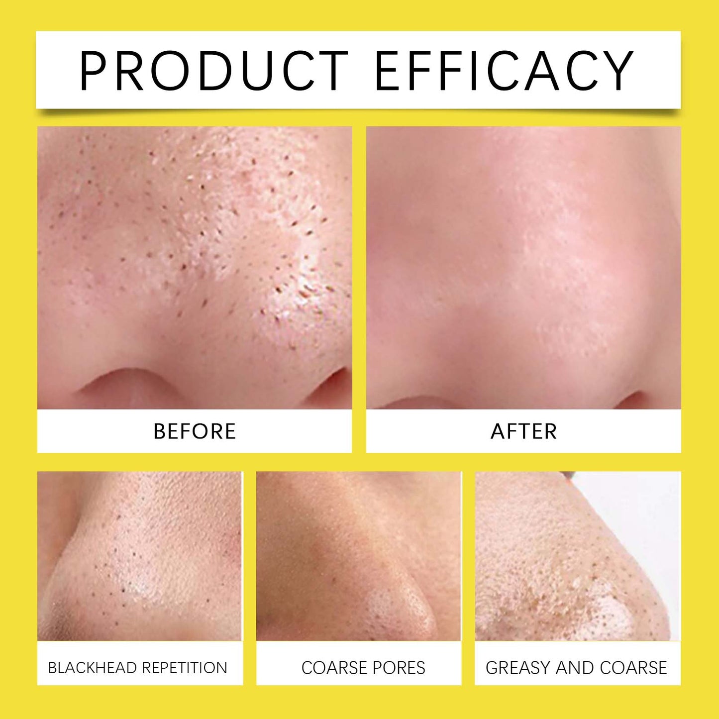 Invisible Pore Purifying Patches