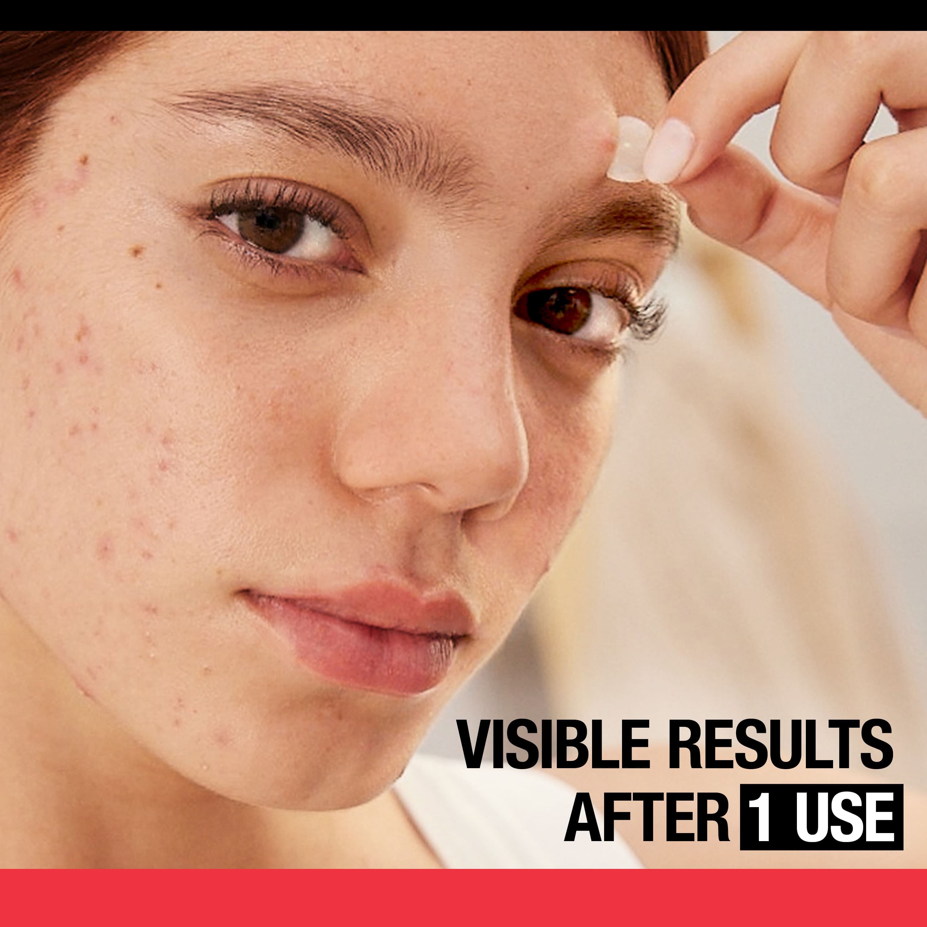 Acne Solutions: Cleanser, Treatment, & Patches, 3 Items