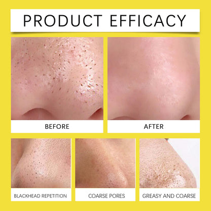 Invisible Pore Purifying Patches