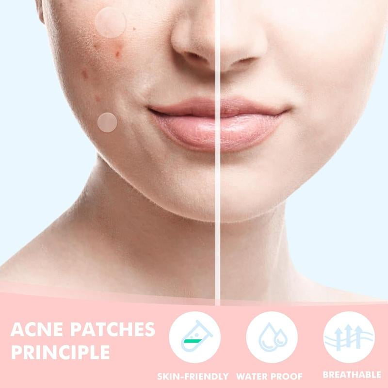 Hydrocolloid Acne Patches for Facial Care - 304 Pieces with Salicylic Acid, Tea Tree Oil, and Calendula Oil