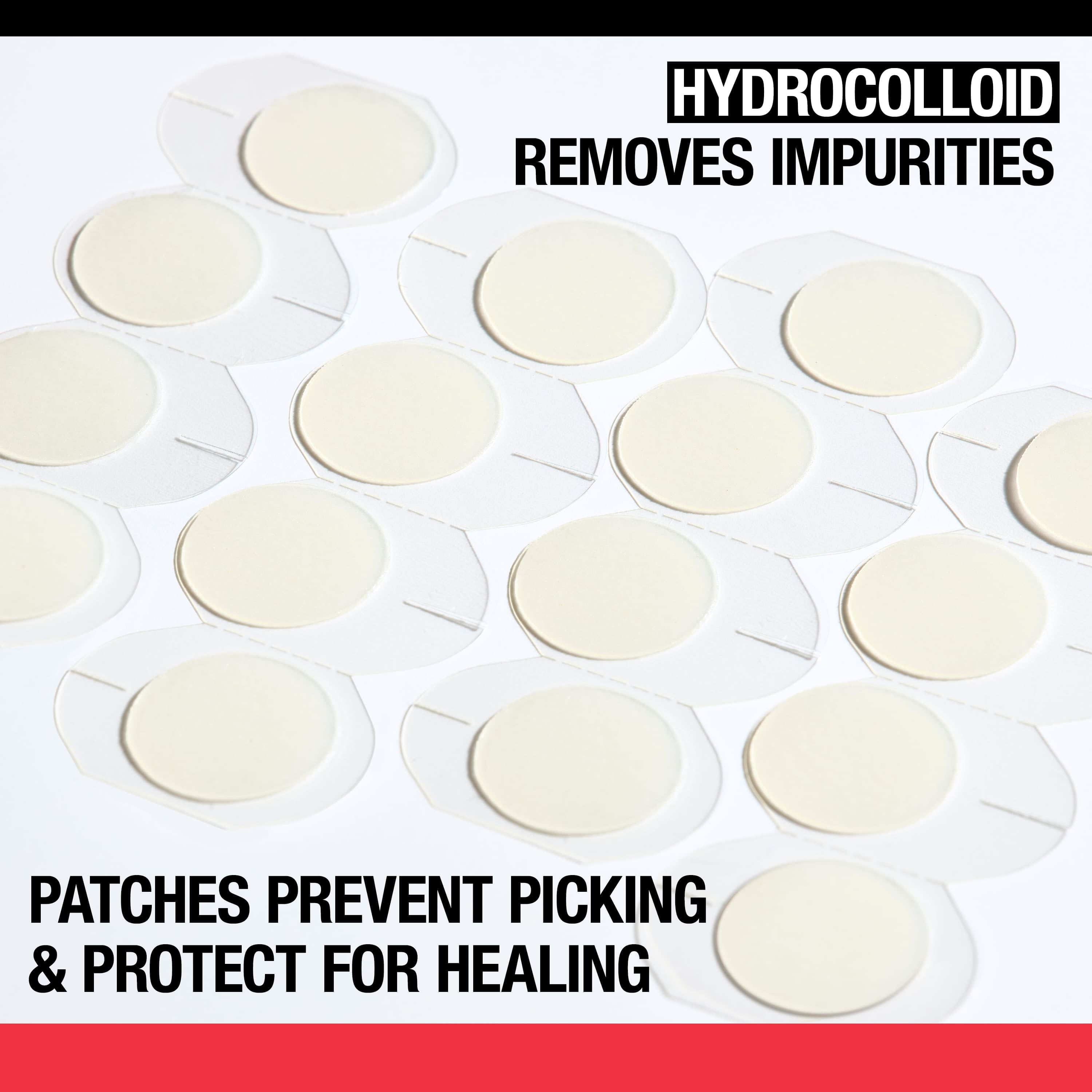 Acne Solutions: Cleanser, Treatment, & Patches, 3 Items